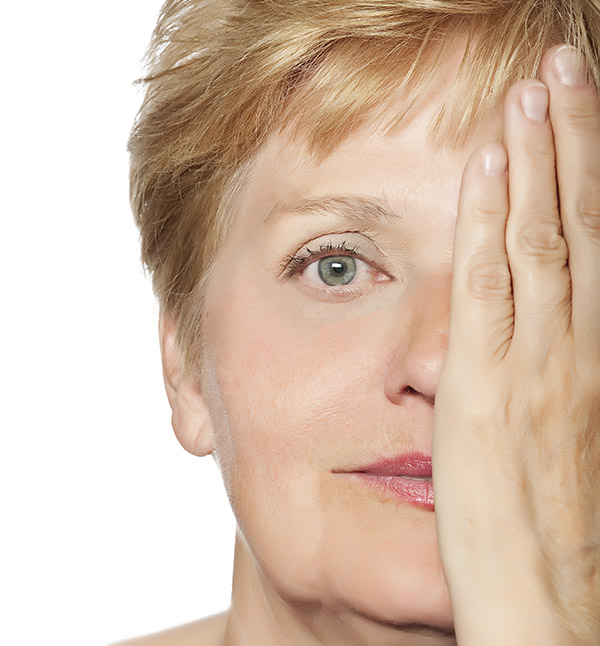After-Anti Aging 