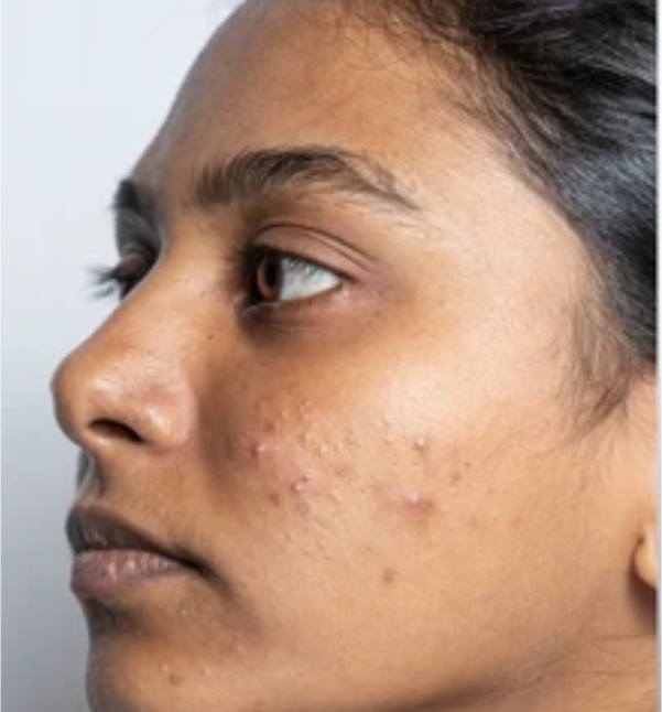Before-facetwo